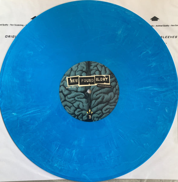 Radiosurgery - secondary