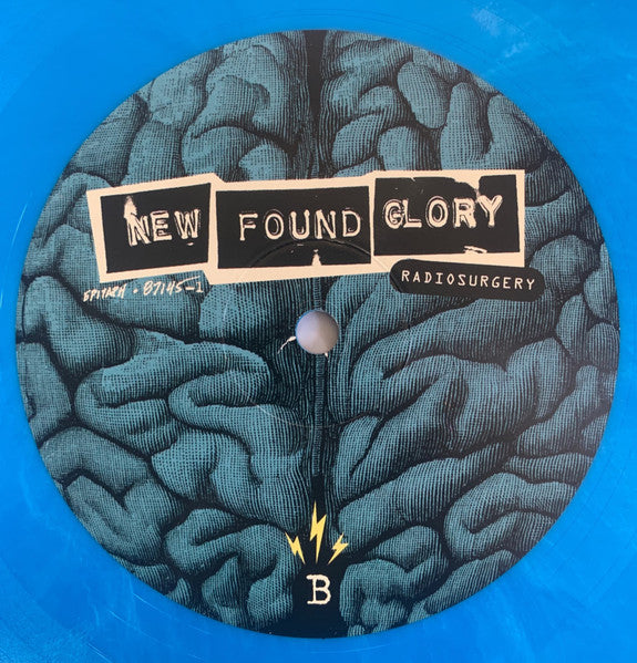 Radiosurgery - secondary