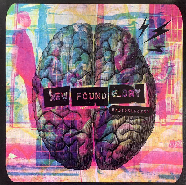 Radiosurgery - primary