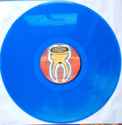 Are You Normal? - secondary